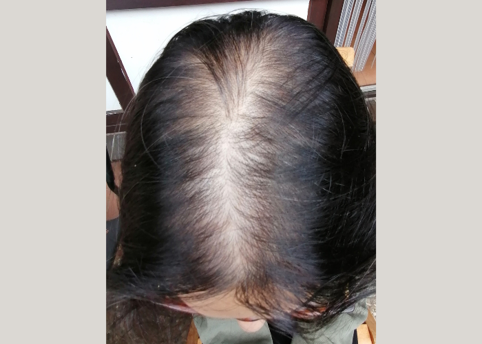 Active Scalp Renewal - Hair Serum