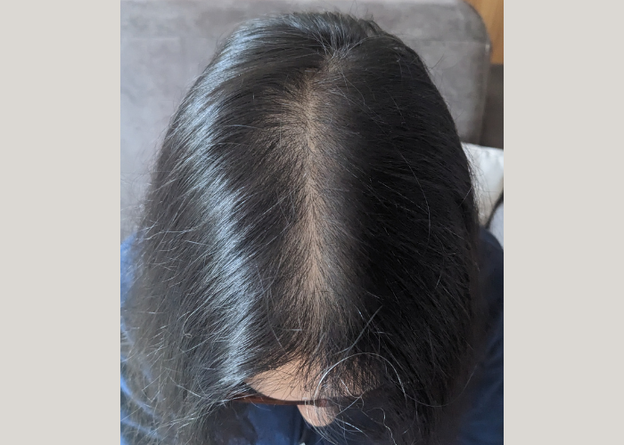 Active Scalp Renewal - Hair Serum